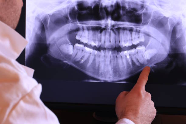 Best Emergency Treatment for Oral Infections in Brighton, MI