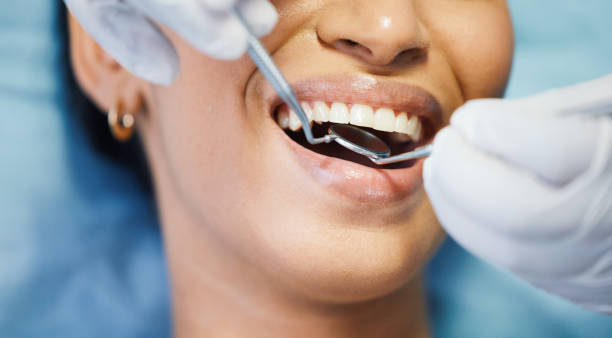 Best Broken or Chipped Tooth Repair in Brighton, MI