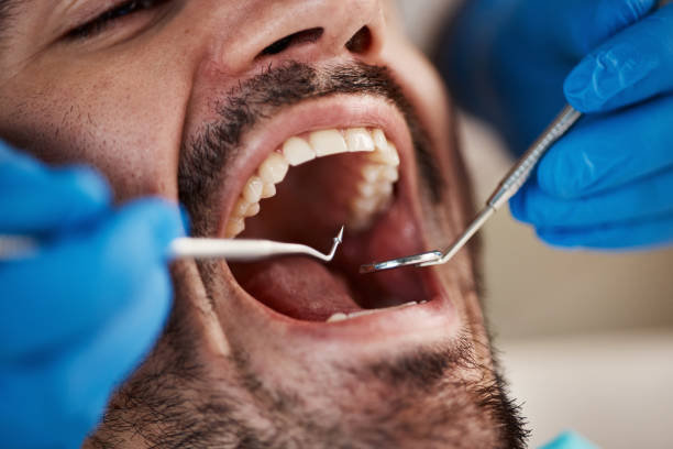 Best Emergency Care for Gum Disease in Brighton, MI